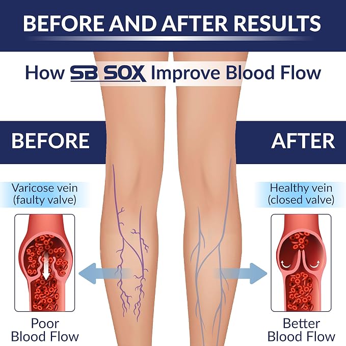 SB SOX Compression Socks for Men & Women