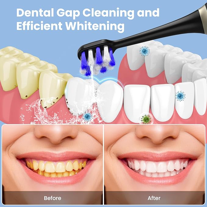 Portable Water flosser with Electric Toothbrush, 2 in 1 Teeth Cleaning Kit